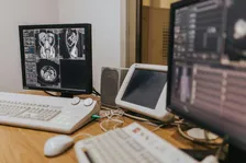 Hospital desk with monitors showing medical scans