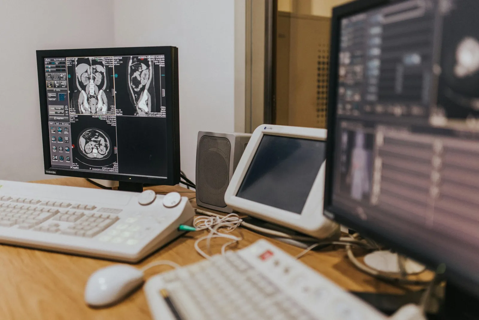 Two computer monitors on a desk showing medical scan images, with a keyboard and mouse in front